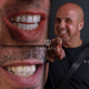 Slider image (9) Dentaray Clinic: luxury Dental Clinic in Istanbul